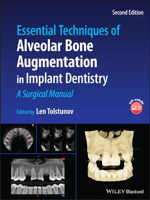cover image of Essential Techniques of Alveolar Bone Augmentation in Implant Dentistry
